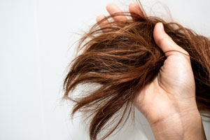 Dry Hair Causes Dry Hair Causes