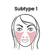 types of rosacea