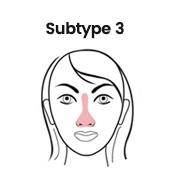 types of rosacea