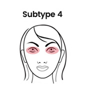 types of rosacea