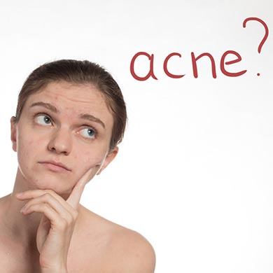 12 Frequently Asked Questions about Acne answered