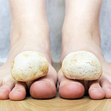 How to take care of Fungal Nail Infection naturally?