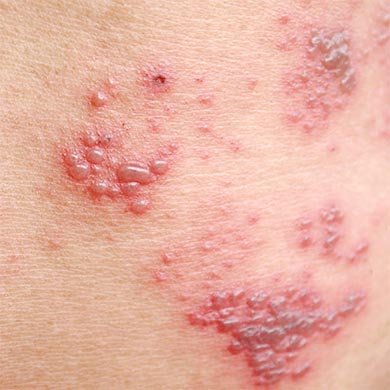 Causes of scaly skin and how to get rid of it