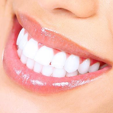 Pain free tricks for teeth whitening