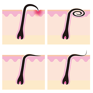 A Bumpy Road To Smooth Skin A Bumpy Road To Smooth Skin