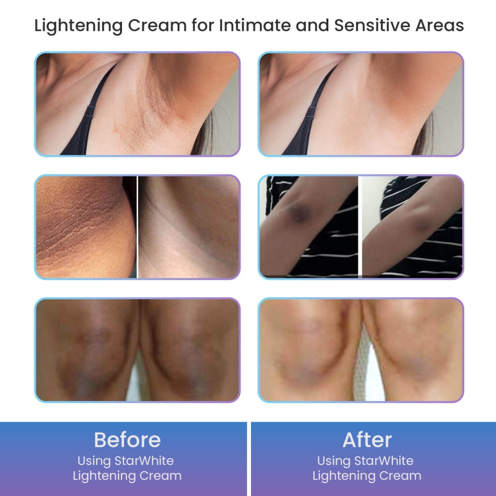 skin lightening cream UK usage results