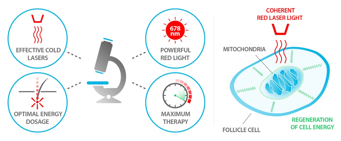 shyuk-theradome-lh80-pro-laser-helmet